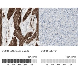 DMPK Antibody, Novus Biologicals:Antibodies:Primary Antibodies